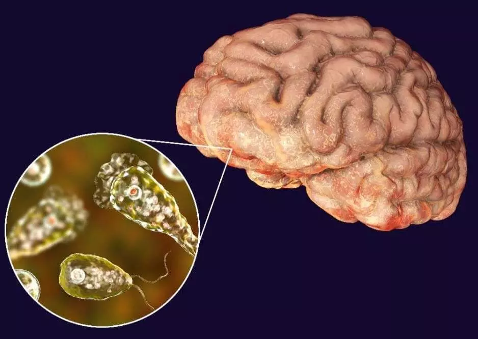 A new virus known as, the brain eating virus has caused 18 deaths in Kerala, India A new virus known as, the brain eating virus has caused 18 deaths in Kerala, India
