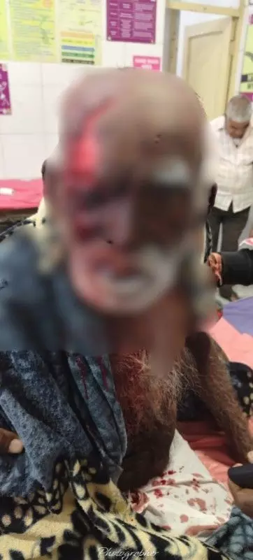 attacked by panther