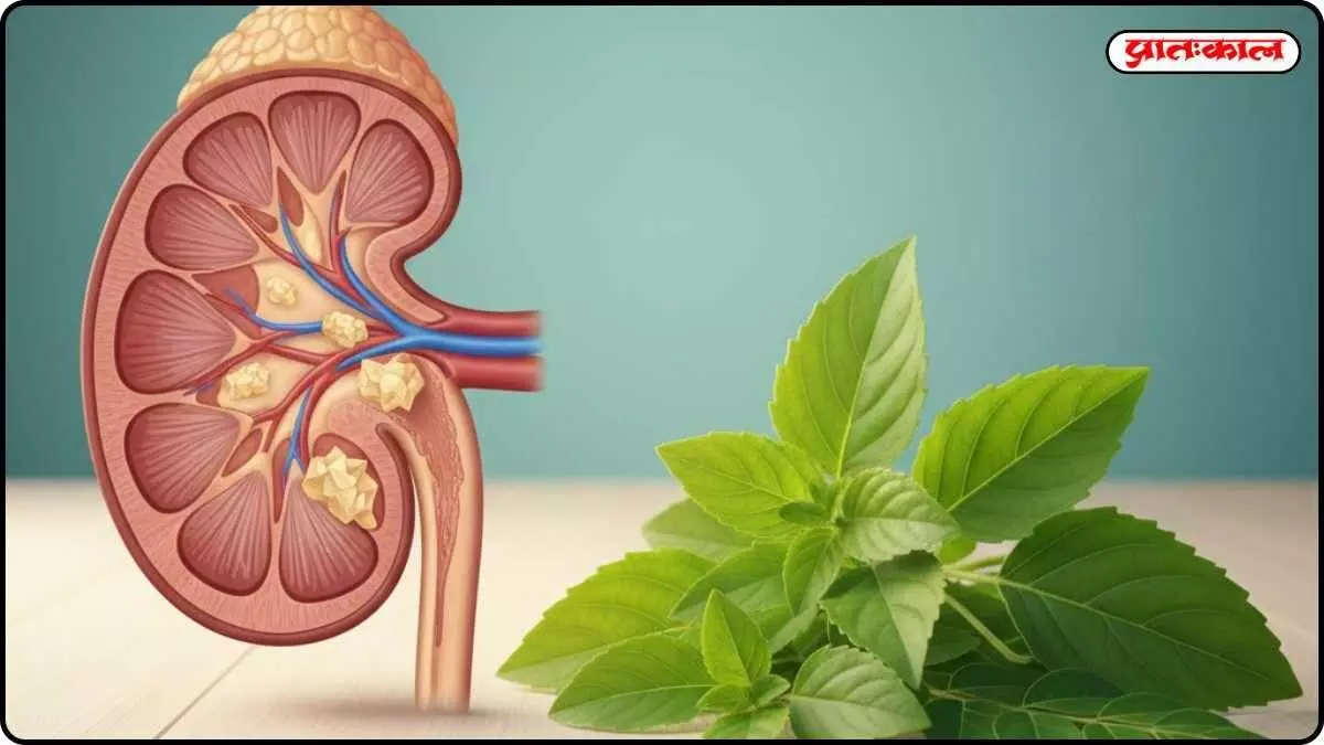 Will make kidney stone pain disappear: Know which remedies will provide relief from the initial symptoms Will make kidney stone pain disappear: Know which remedies will provide relief from the initial symptoms
