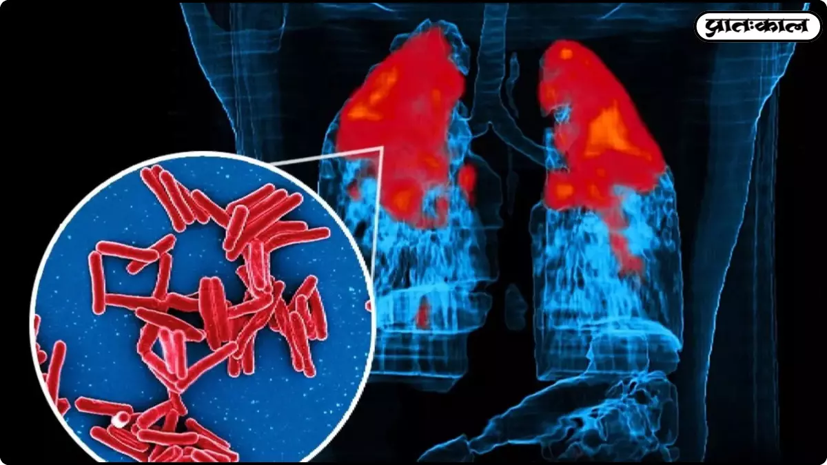 IIT Bombay TB research