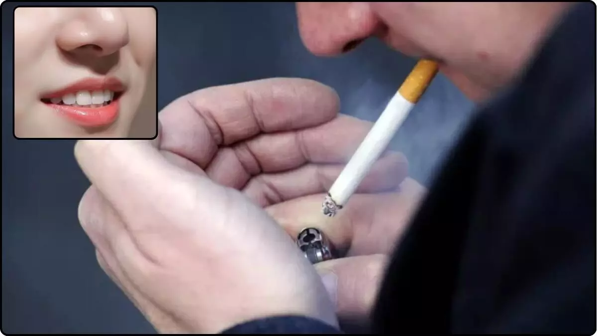 smoking se hoth ka kala padna smoking se hoth ka kala padna