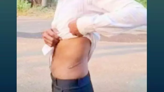 Life trapped in debt: Pressure from moneylenders forces a dairy farmer in Chandrapur to sell his kidney Life trapped in debt: Pressure from moneylenders forces a dairy farmer in Chandrapur to sell his kidney