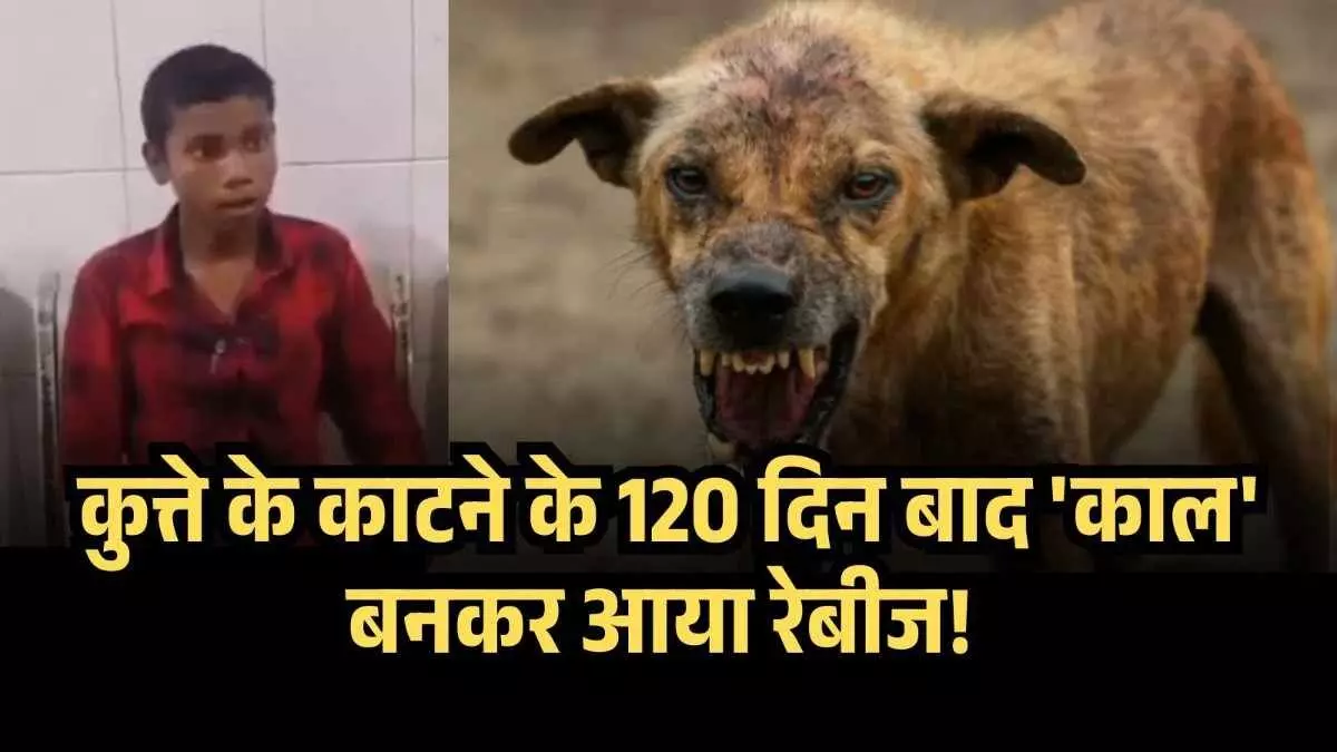 कुत्ते के काटने पर 2 इंजेक्शन लगवाए और छोड़ दिया कोर्स, अब 4 महीने बाद कुत्ते की तरह व्यवहार करने लगा मासूम कुत्ते के काटने पर 2 इंजेक्शन लगवाए और छोड़ दिया कोर्स, अब 4 महीने बाद कुत्ते की तरह व्यवहार करने लगा मासूम