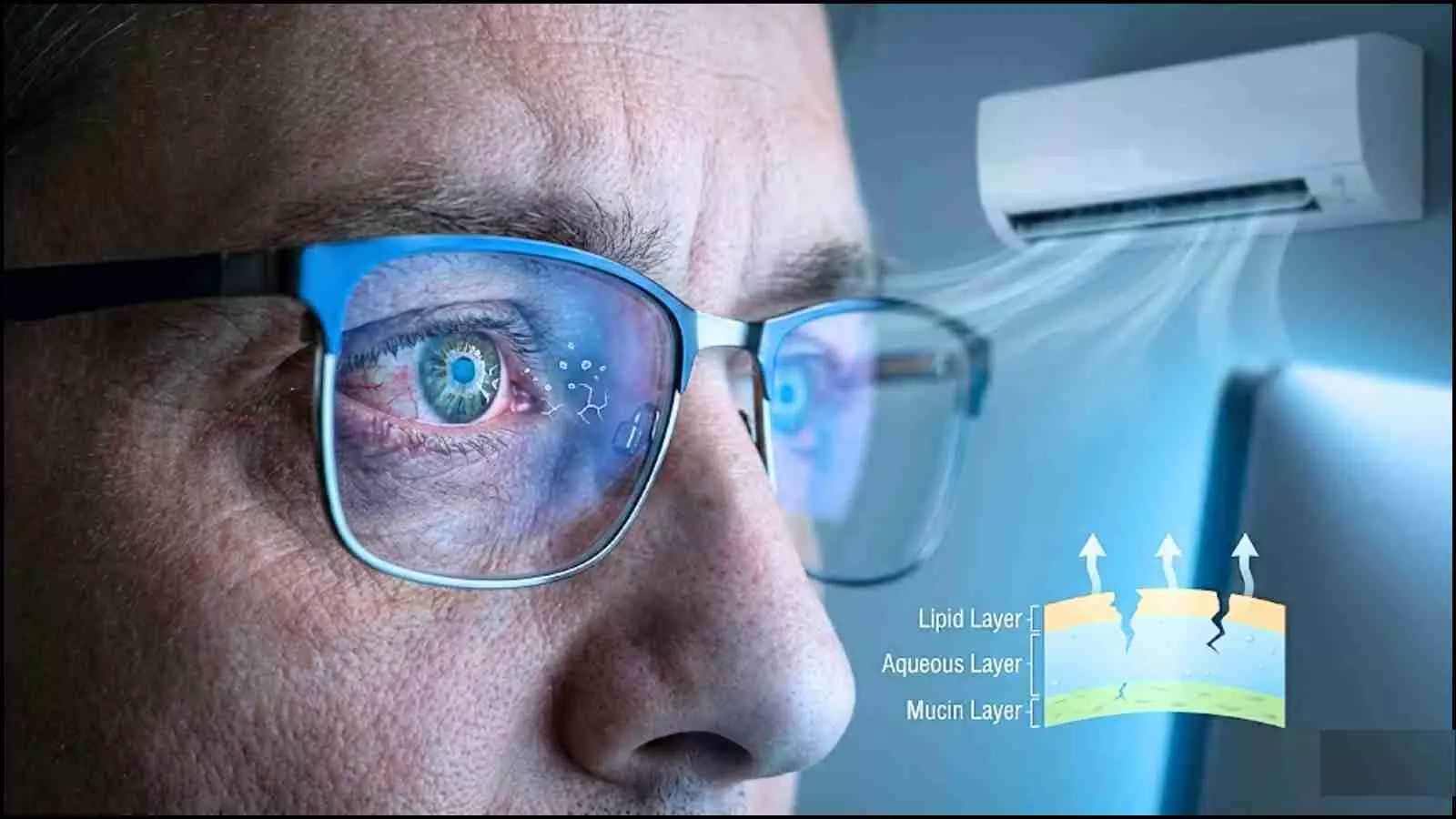 एयर कंडीशनर की ठंडी हवा और स्क्रीन की रोशनी के बीच आँखों में जलन महसूस करता व्यक्ति; इमेज एआई द्वारा केवल उदाहरण के लिए बनाई गई है