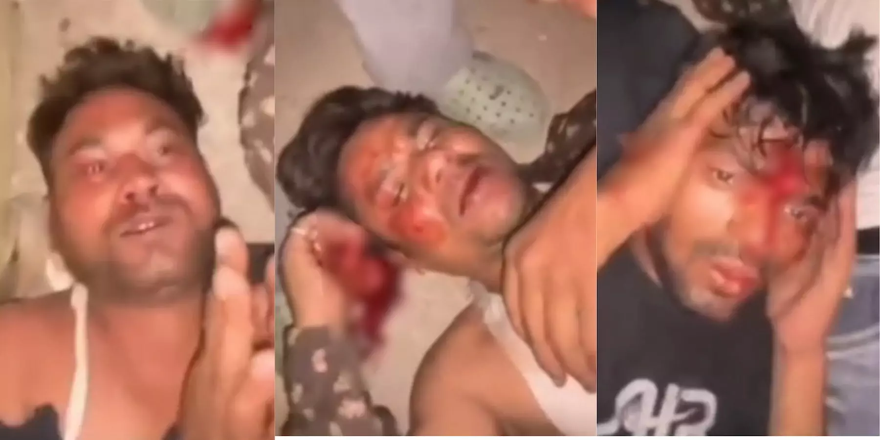 राजसमंद के राजावास में ग्रामीणों द्वारा पकड़े गए घायल संदिग्ध युवक और पुलिस कार्रवाई का दृश्य। राजसमंद के राजावास में ग्रामीणों द्वारा पकड़े गए घायल संदिग्ध युवक और पुलिस कार्रवाई का दृश्य।