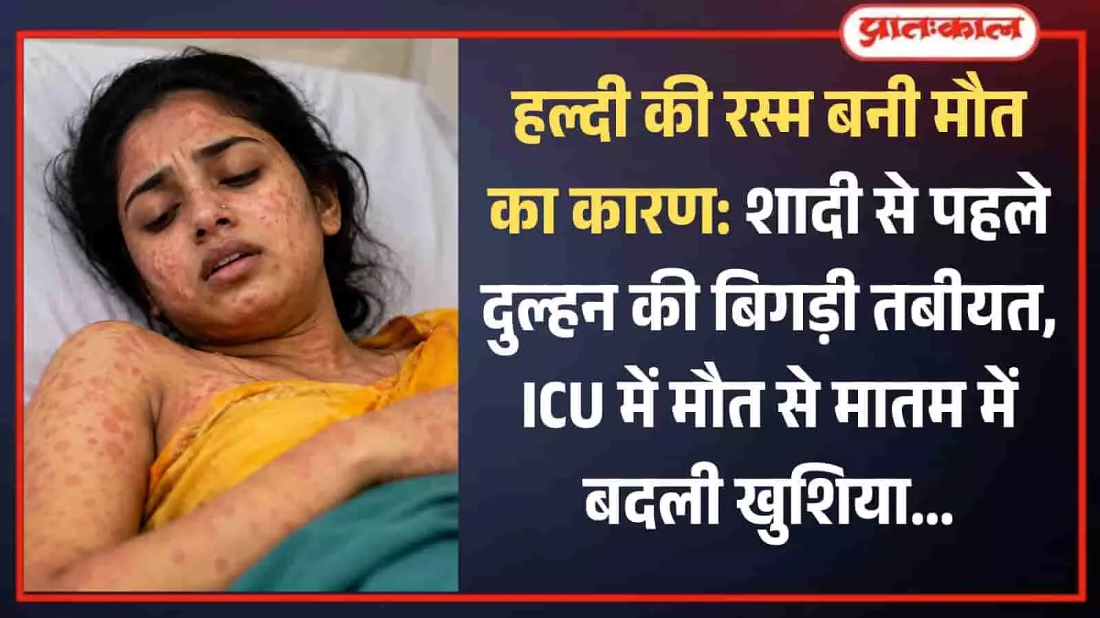 अस्पताल के बिस्तर पर लेटी युवती जिसके शरीर पर गंभीर एलर्जी के लाल निशान दिख रहे हैं।