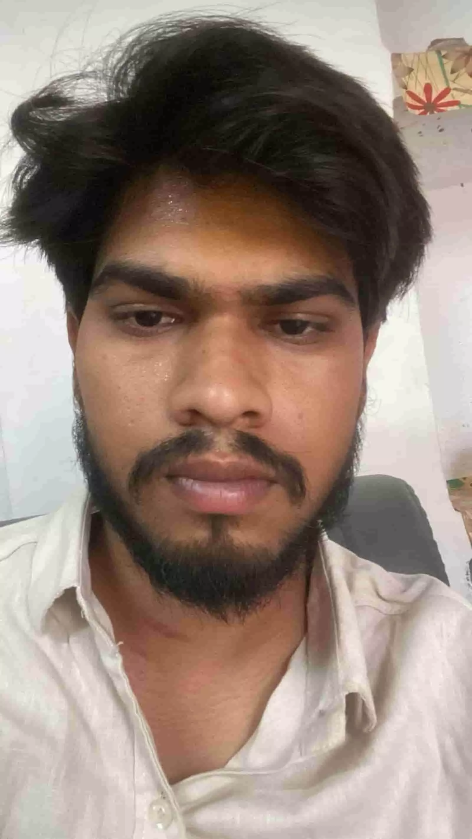झांसी के मोंठ में मारपीट का शिकार हुआ युवक अंकित जिसका चेहरा तस्वीर में दिखाई दे रहा है। झांसी के मोंठ में मारपीट का शिकार हुआ युवक अंकित जिसका चेहरा तस्वीर में दिखाई दे रहा है।