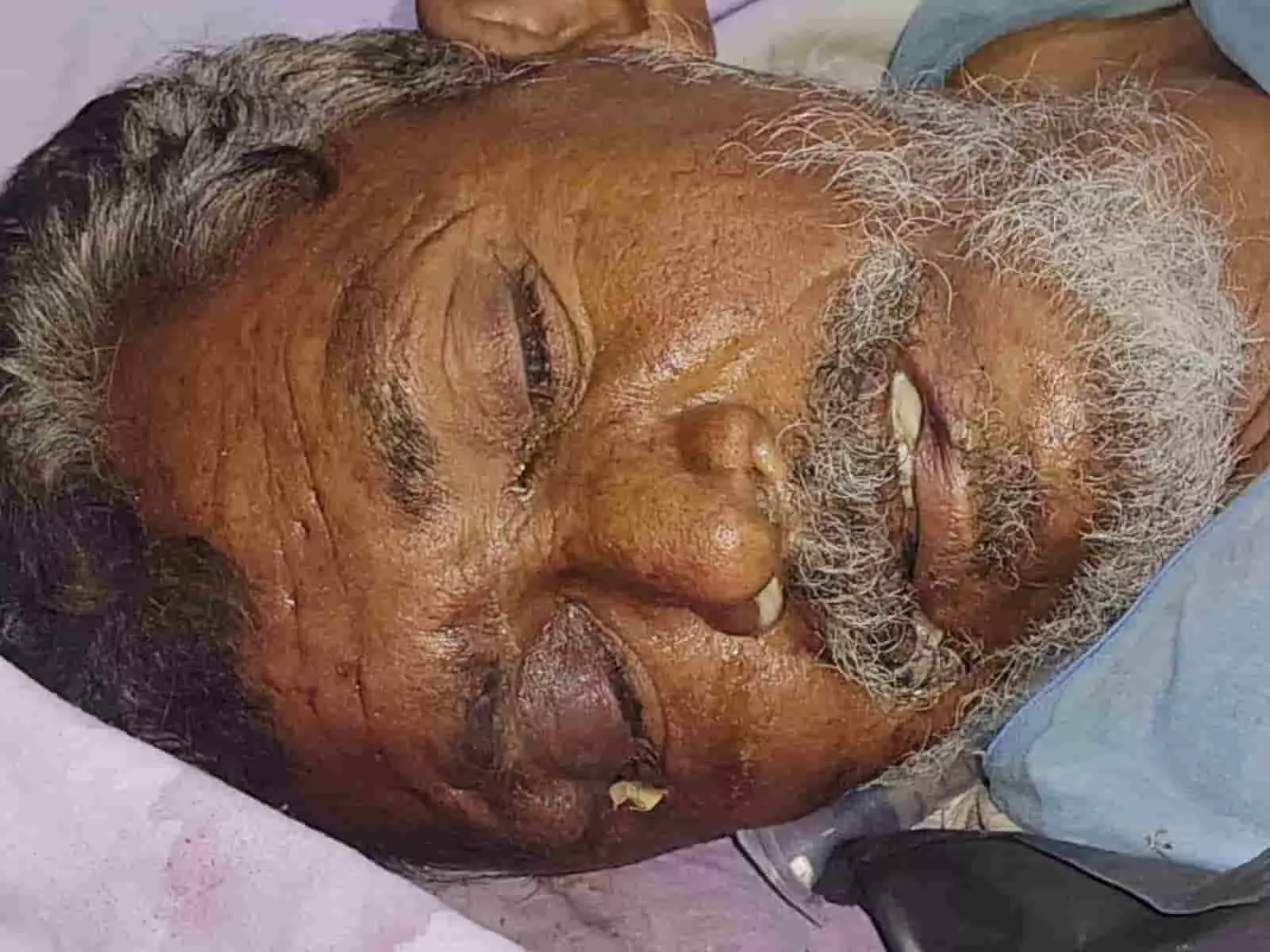भीलवाड़ा: अस्पताल के पास घायल मिले अज्ञात शख्स की मौत, हाथ पर गुदा है रुहेलाल कीर नाम