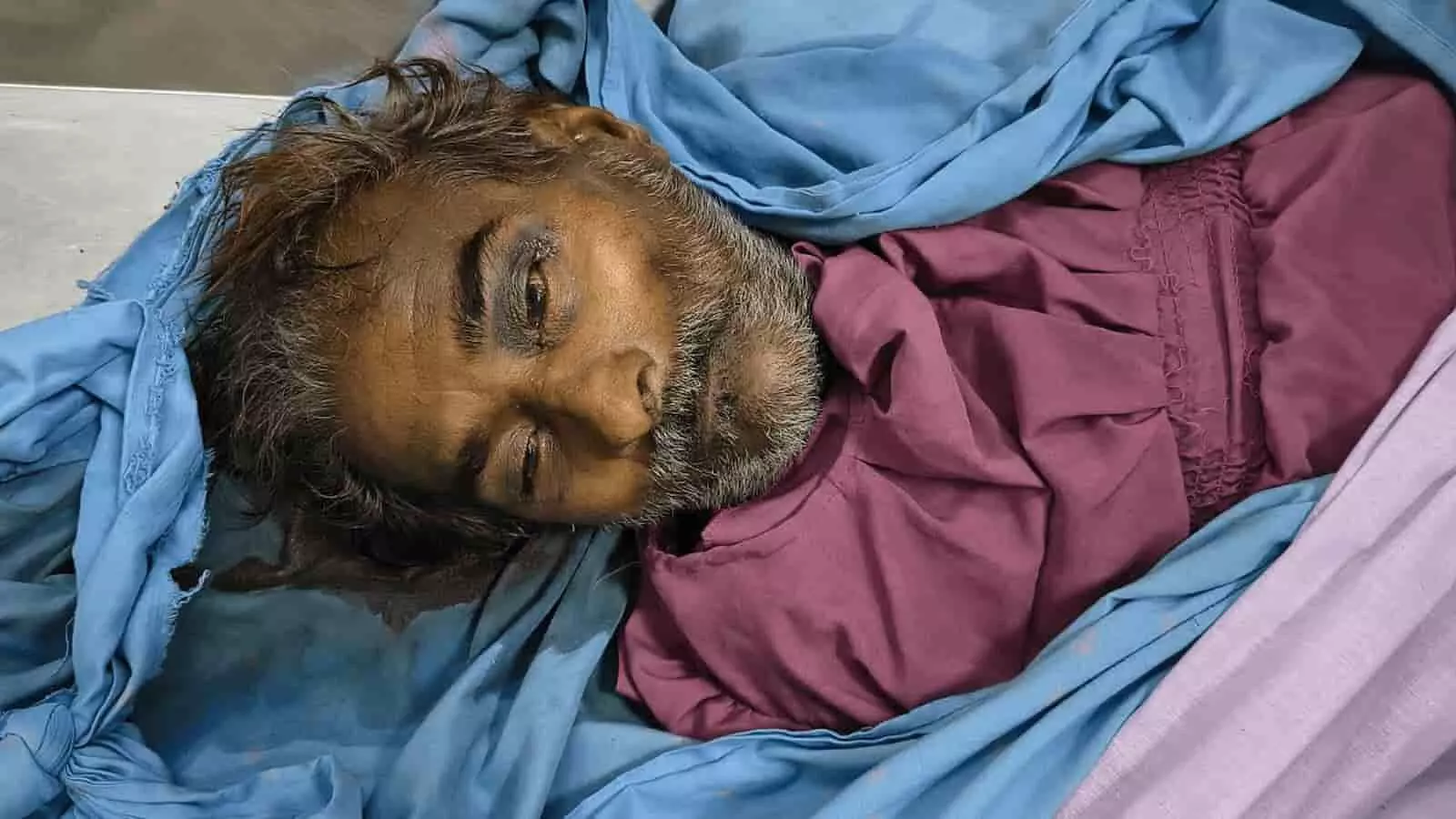 अस्पताल की मोर्चरी में नीले और बैंगनी कपड़ों से ढका हुआ एक अज्ञात मृतक व्यक्ति का शव शिनाख्त के संदर्भ में दिख रहा है। अस्पताल की मोर्चरी में नीले और बैंगनी कपड़ों से ढका हुआ एक अज्ञात मृतक व्यक्ति का शव शिनाख्त के संदर्भ में दिख रहा है।