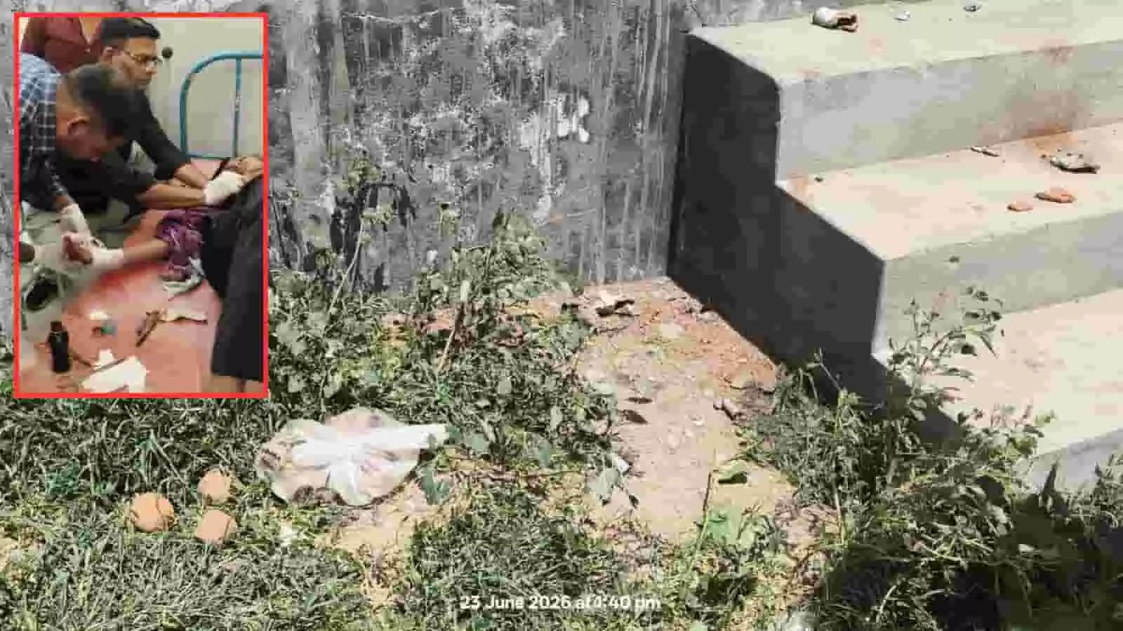 अलीगंज में विस्फोट के बाद खाली मैदान और अस्पताल में डॉक्टरों द्वारा घायल युवक का उपचार किया जा रहा है। अलीगंज में विस्फोट के बाद खाली मैदान और अस्पताल में डॉक्टरों द्वारा घायल युवक का उपचार किया जा रहा है।