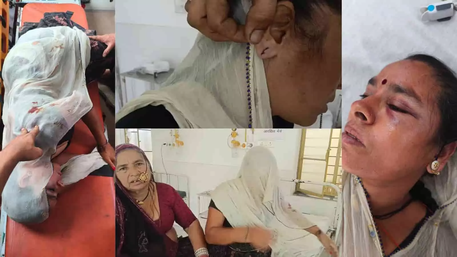 आमेट के अस्पताल में स्ट्रेचर और बेड पर लेटी घायल महिला और उनके परिजन आमेट के अस्पताल में स्ट्रेचर और बेड पर लेटी घायल महिला और उनके परिजन