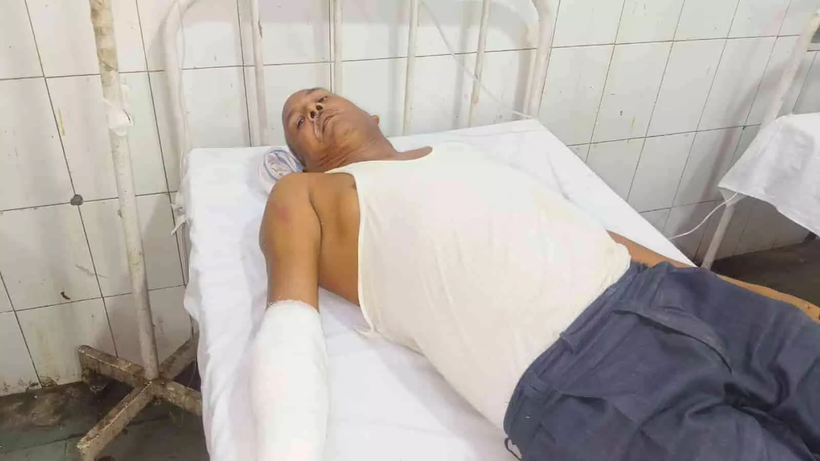 अस्पताल के बेड पर लेटा हुआ घायल व्यक्ति बयाना के चीखरु गांव में मारपीट के बाद उपचार के संदर्भ में। अस्पताल के बेड पर लेटा हुआ घायल व्यक्ति बयाना के चीखरु गांव में मारपीट के बाद उपचार के संदर्भ में।