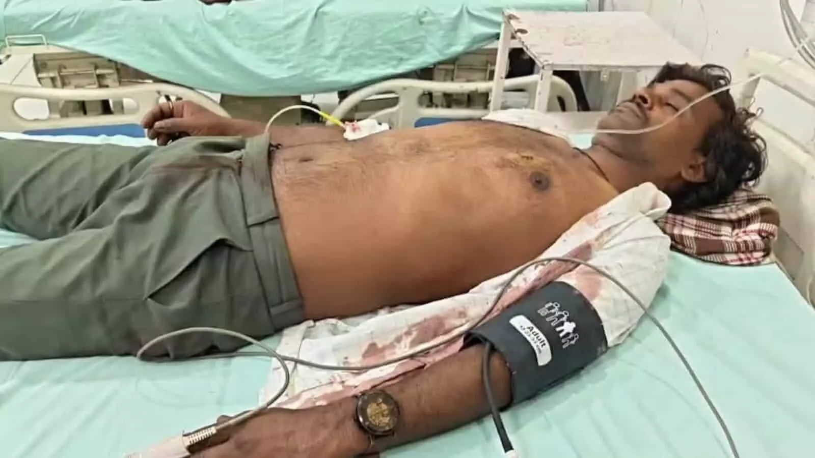 भीलवाड़ा के जिला अस्पताल के बेड पर लेटा हुआ घायल व्यक्ति जिसका प्राथमिक उपचार किया जा रहा है। भीलवाड़ा के जिला अस्पताल के बेड पर लेटा हुआ घायल व्यक्ति जिसका प्राथमिक उपचार किया जा रहा है।