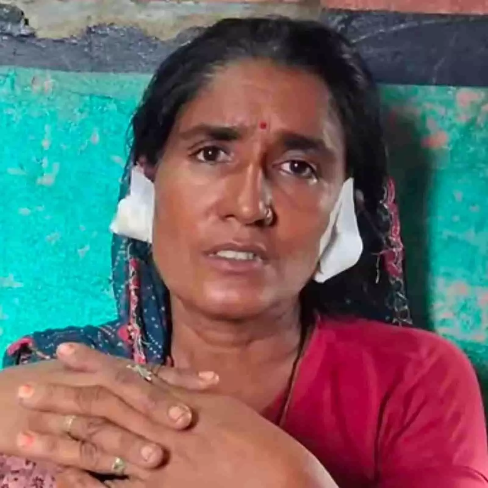 तस्वीर में कानों पर पट्टी बांधी हुई पीड़ित महिला भीलवाड़ा के सांगणी गांव में बैठी दिख रही है।