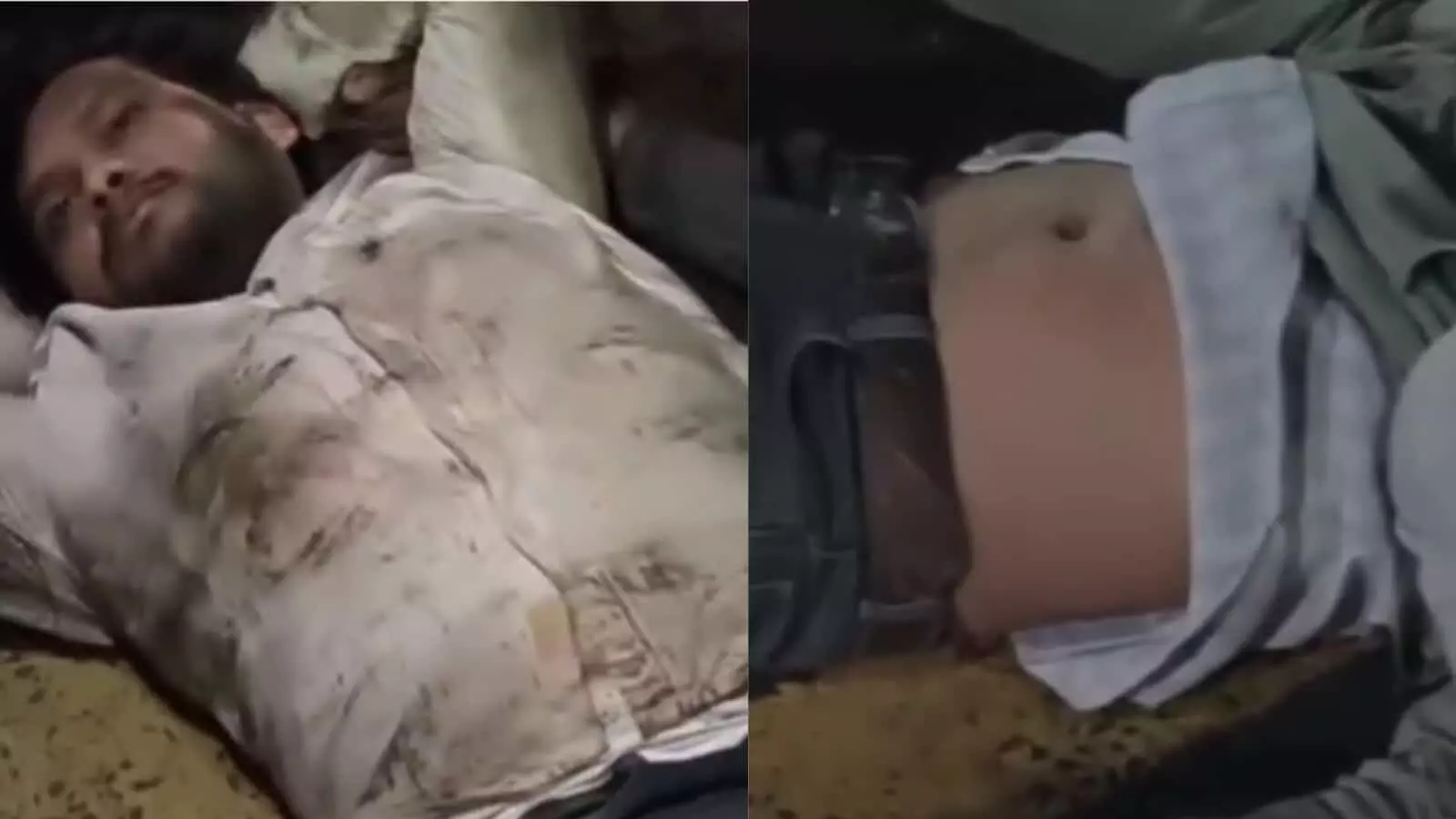 लातूर फ्लायओवर हादसे में घायल हुए दो युवक अस्पताल में नजर आ रहे हैं। लातूर फ्लायओवर हादसे में घायल हुए दो युवक अस्पताल में नजर आ रहे हैं।