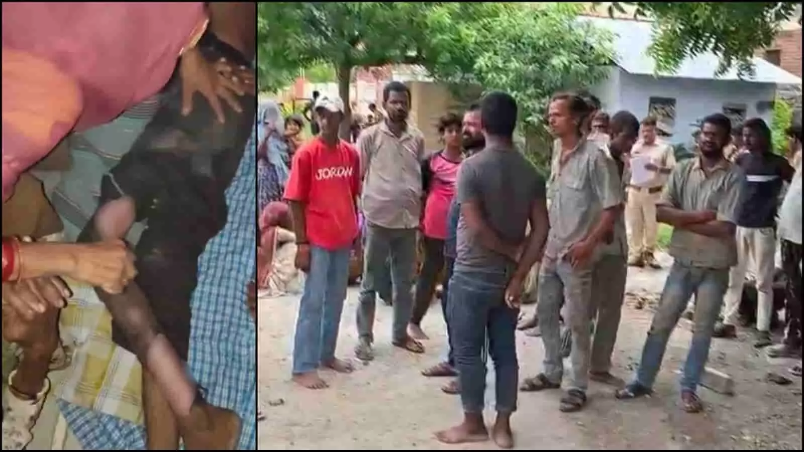 तस्वीर में परिजन चोट के निशान दिखाते हुए और ग्रामीण एकत्रित खड़े दिखाई दे रहे हैं। तस्वीर में परिजन चोट के निशान दिखाते हुए और ग्रामीण एकत्रित खड़े दिखाई दे रहे हैं।