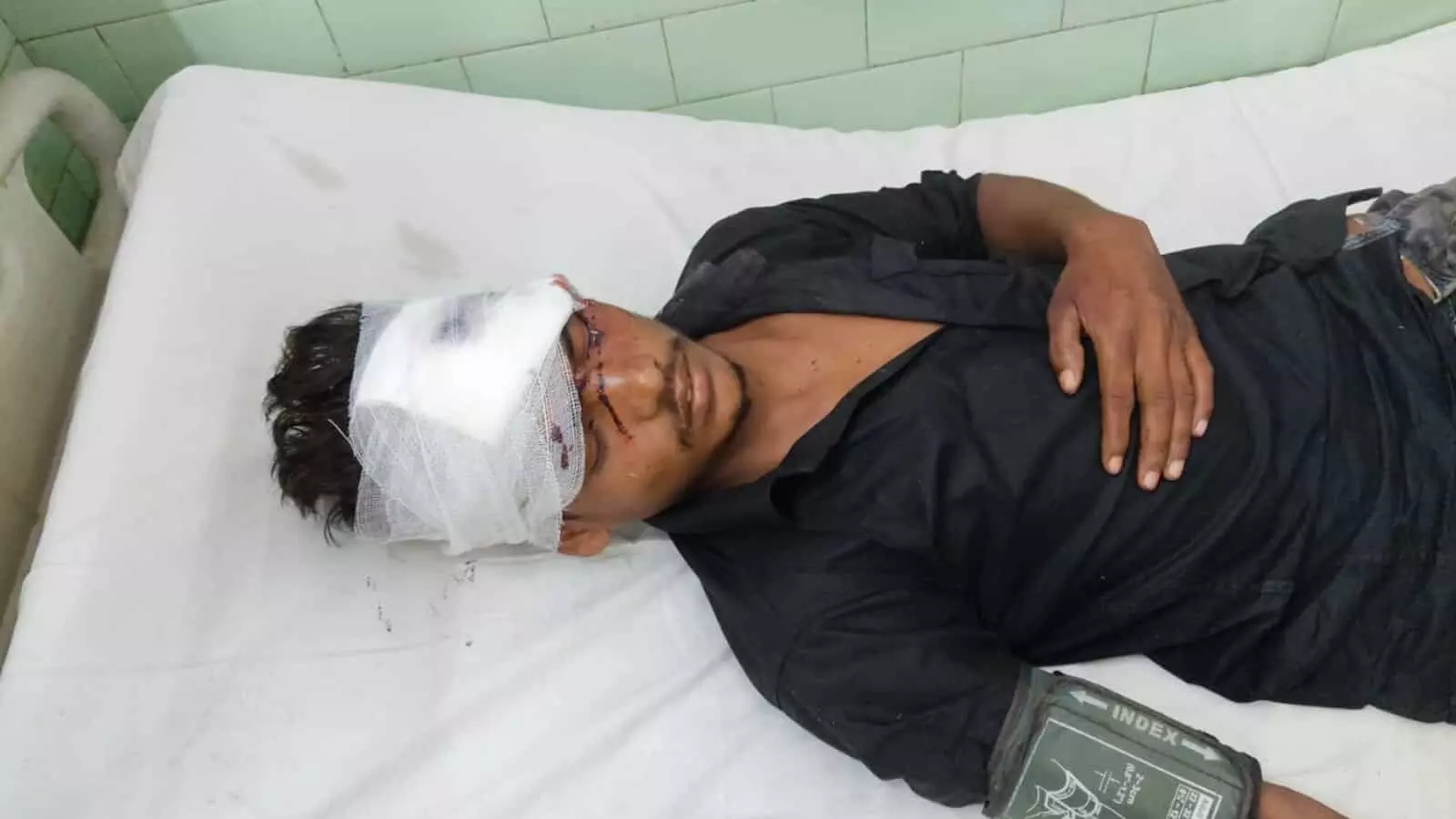 अस्पताल के बेड पर सिर पर पट्टी बंधे लेटा घायल युवक बरेली में। अस्पताल के बेड पर सिर पर पट्टी बंधे लेटा घायल युवक बरेली में।