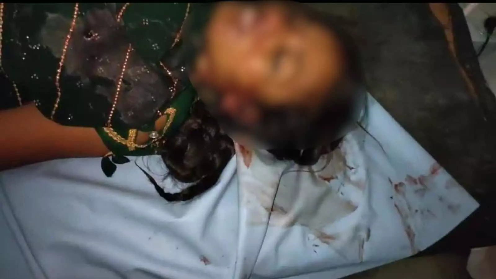 तस्वीर में अस्पताल की बेड पर लेटी हुई घायल महिला दिखाई दे रही है। तस्वीर में अस्पताल की बेड पर लेटी हुई घायल महिला दिखाई दे रही है।