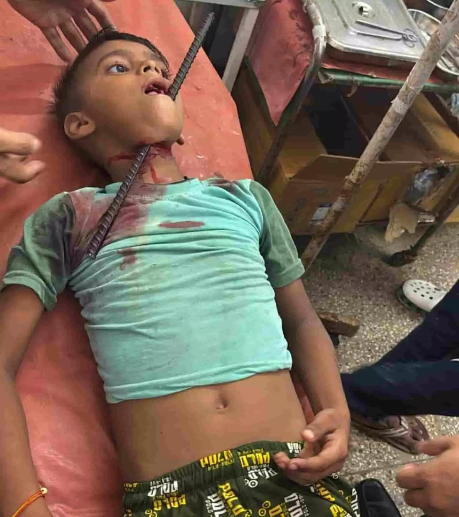 तस्वीर में दिख रही एटा अस्पताल की बेड पर लेटे बच्चे का इलाज करते स्वास्थ्यकर्मी। तस्वीर में दिख रही एटा अस्पताल की बेड पर लेटे बच्चे का इलाज करते स्वास्थ्यकर्मी।