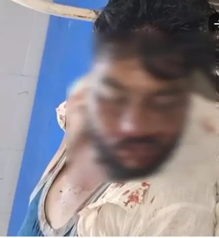 तस्वीर में घायल अवस्था में लेटे हुए युवक का चेहरा दिखाई दे रहा है। तस्वीर में घायल अवस्था में लेटे हुए युवक का चेहरा दिखाई दे रहा है।