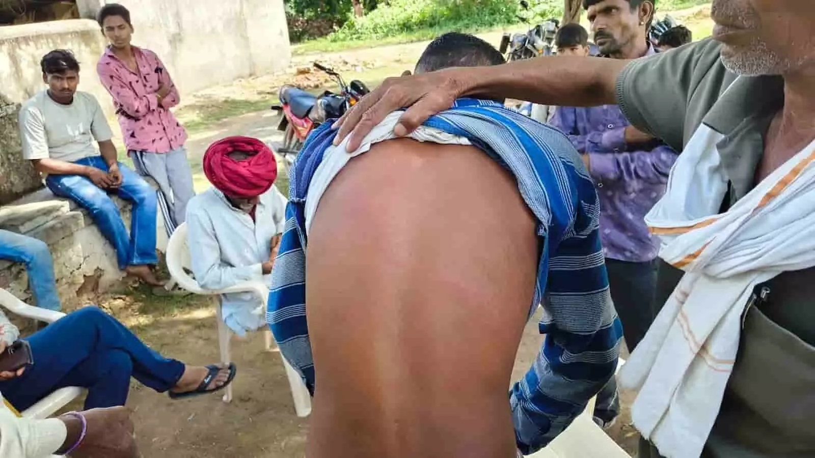 तस्वीर में एक व्यक्ति अपनी पीठ पर लगे चोट के निशान दिखा रहा है और आसपास ग्रामीण लोग खड़े हैं। तस्वीर में एक व्यक्ति अपनी पीठ पर लगे चोट के निशान दिखा रहा है और आसपास ग्रामीण लोग खड़े हैं।