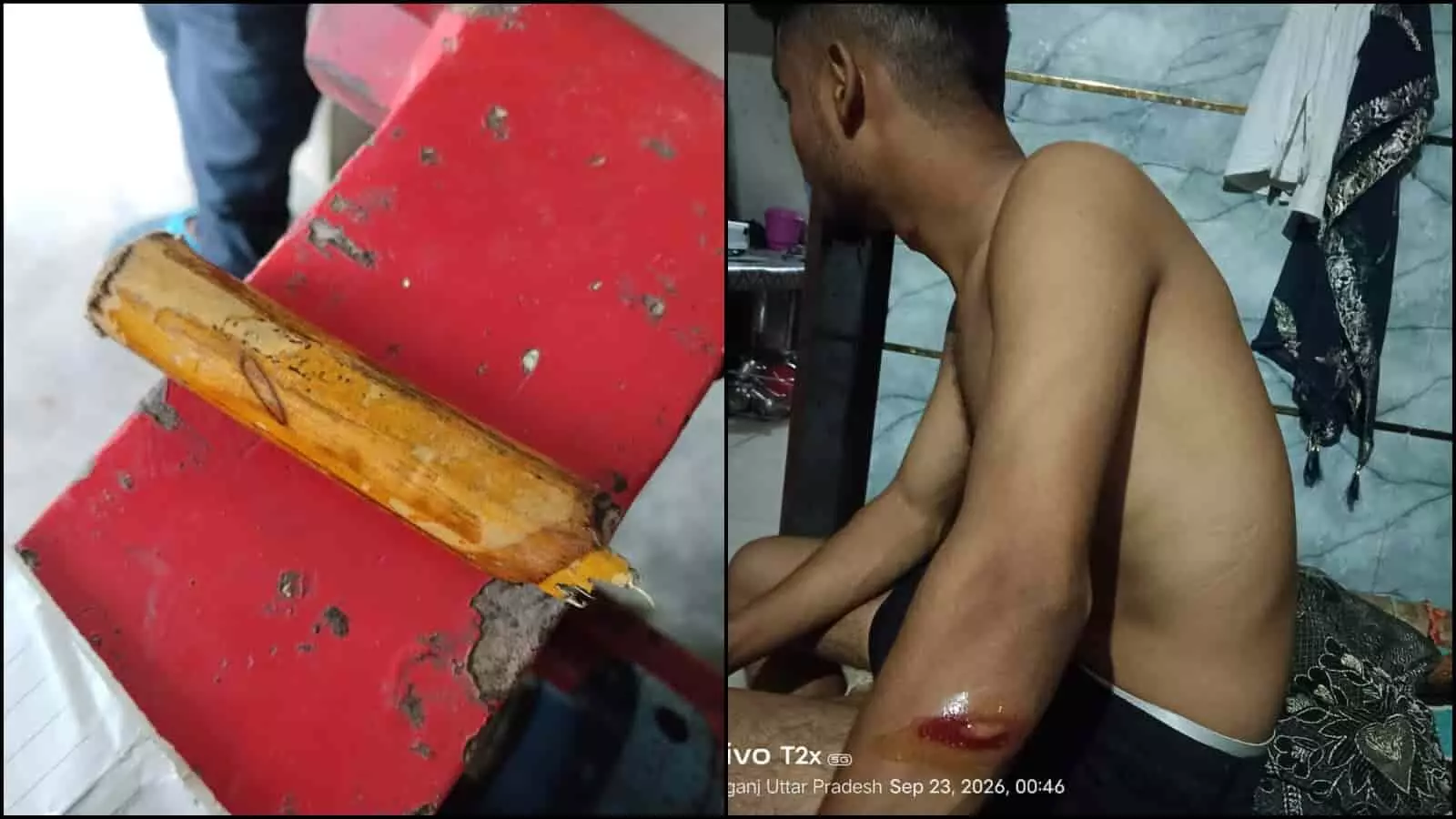 तस्वीर में अलीगंज में डंडा और घायल व्यक्ति के हाथ पर चोट का निशान दिख रहा है। तस्वीर में अलीगंज में डंडा और घायल व्यक्ति के हाथ पर चोट का निशान दिख रहा है।