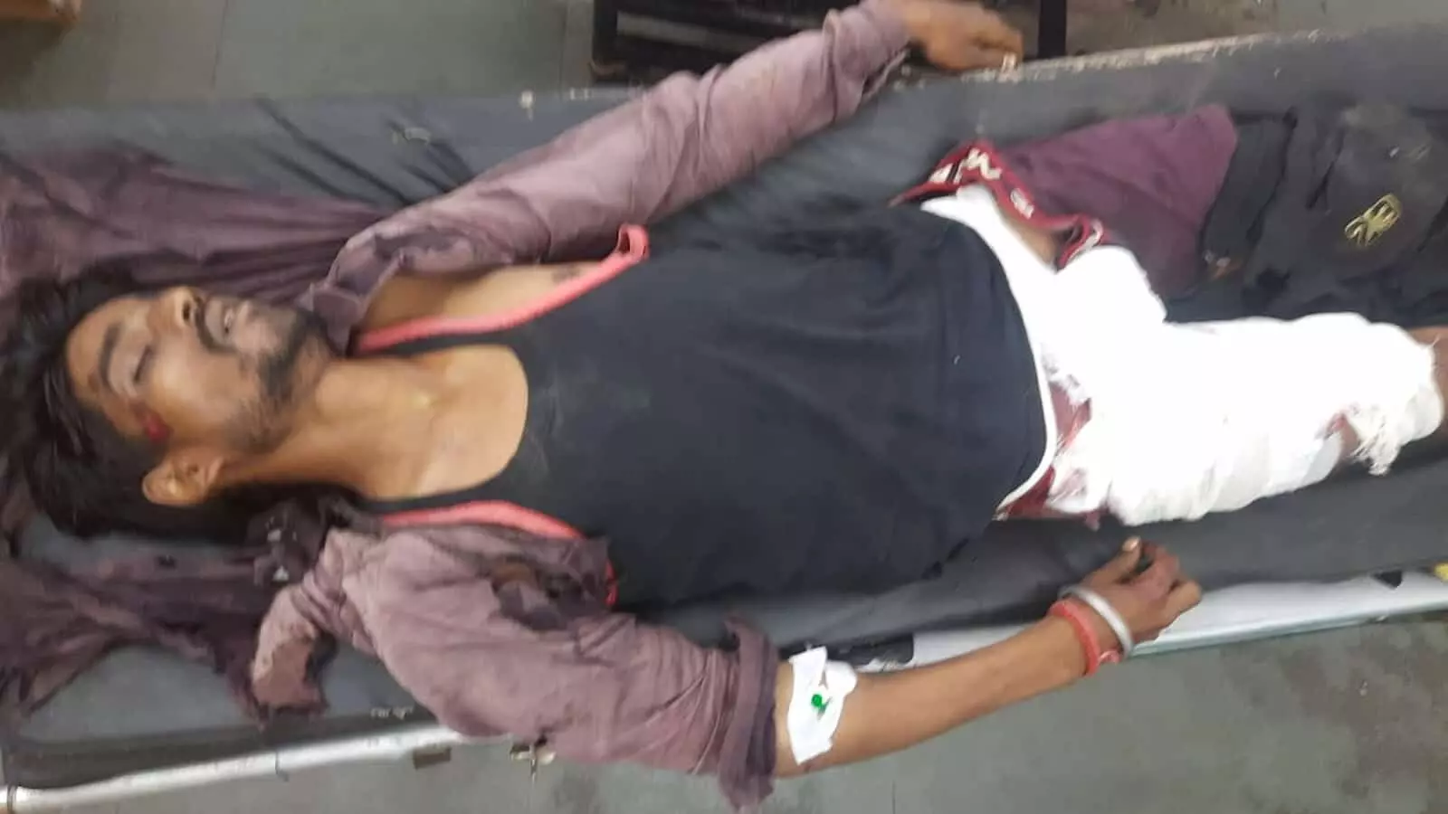 तस्वीर में दिख रहा घायल व्यक्ति अस्पताल के स्ट्रेचर पर इलाज के लिए लेटा हुआ है। तस्वीर में दिख रहा घायल व्यक्ति अस्पताल के स्ट्रेचर पर इलाज के लिए लेटा हुआ है।