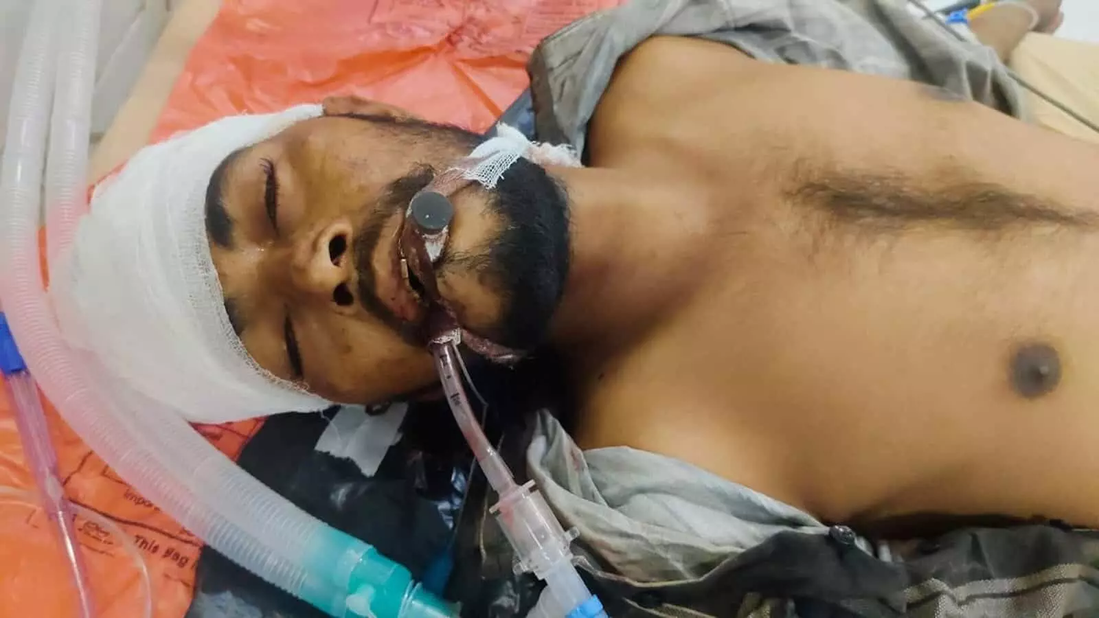 तस्वीर में भीलवाड़ा हाईवे पर मिले अज्ञात घायल युवक का अजमेर अस्पताल में उपचार। तस्वीर में भीलवाड़ा हाईवे पर मिले अज्ञात घायल युवक का अजमेर अस्पताल में उपचार।
