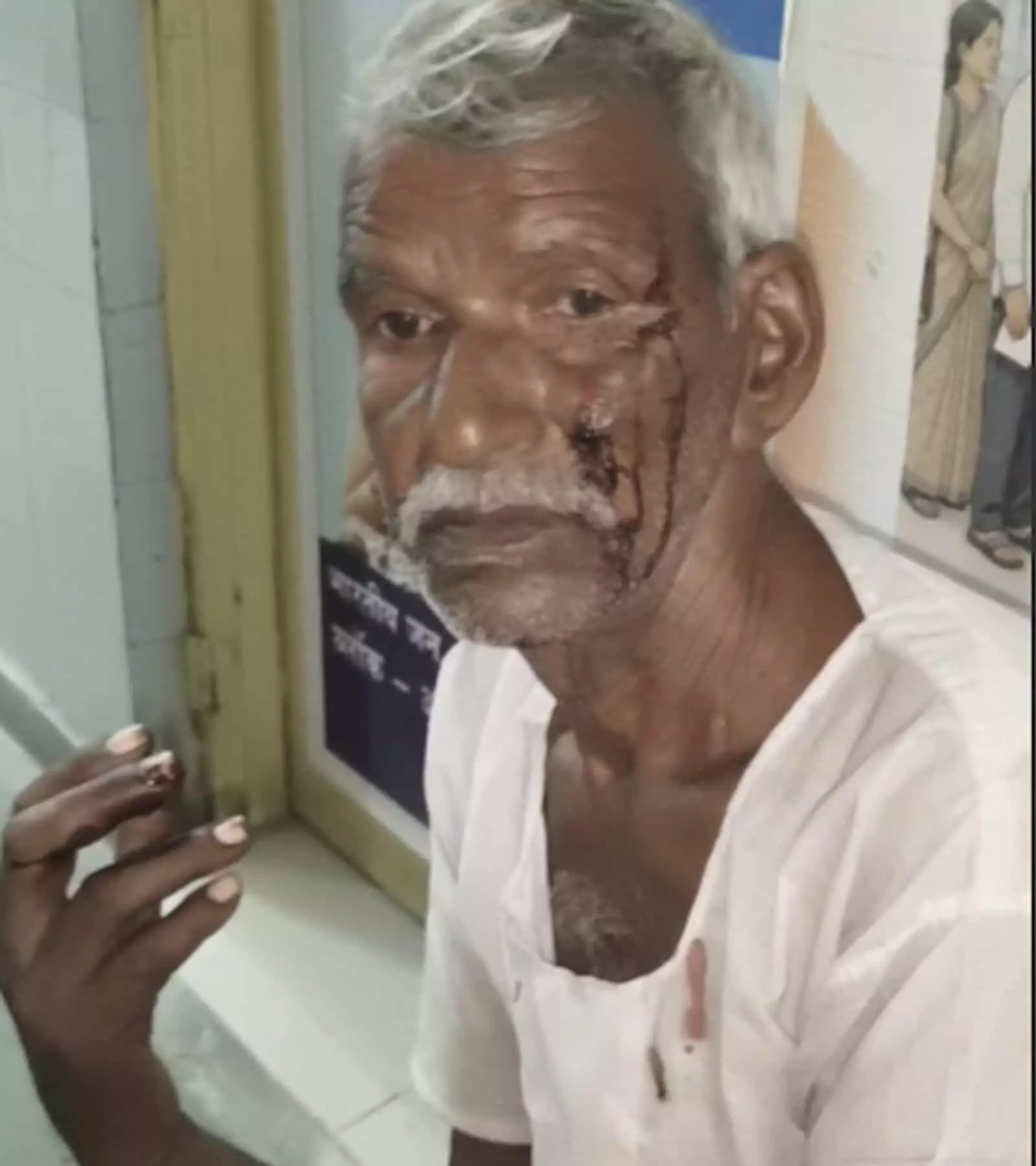 तस्वीर में चेहरे पर चोट के निशान के साथ बुजुर्ग दुकानदार महावीर अलीगंज अस्पताल में दिख रहे हैं। तस्वीर में चेहरे पर चोट के निशान के साथ बुजुर्ग दुकानदार महावीर अलीगंज अस्पताल में दिख रहे हैं।