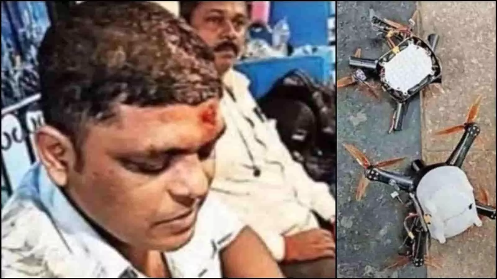 तस्वीर में सिर पर चोट के निशान के साथ घायल व्यक्ति और दूसरी तरफ गिरे हुए ड्रोन दिख रहे हैं। तस्वीर में सिर पर चोट के निशान के साथ घायल व्यक्ति और दूसरी तरफ गिरे हुए ड्रोन दिख रहे हैं।