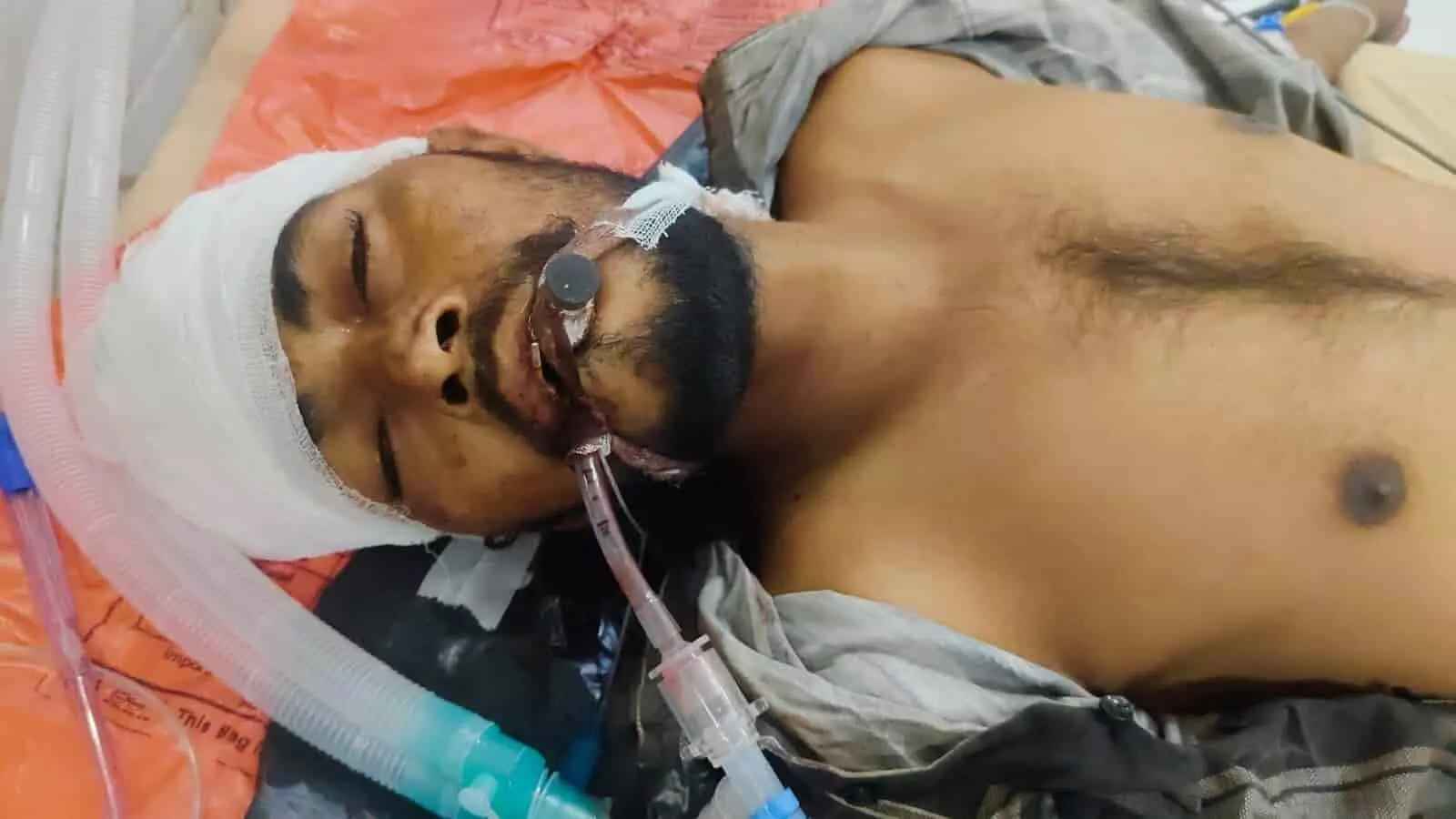 तस्वीर में अस्पताल के बेड पर सिर में पट्टी बांधे और मेडिकल ट्यूब लगे घायल युवक का इलाज चल रहा है। तस्वीर में अस्पताल के बेड पर सिर में पट्टी बांधे और मेडिकल ट्यूब लगे घायल युवक का इलाज चल रहा है।